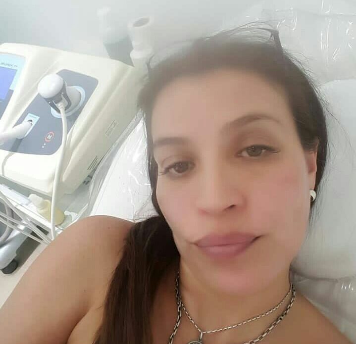 Tratamientos faciales